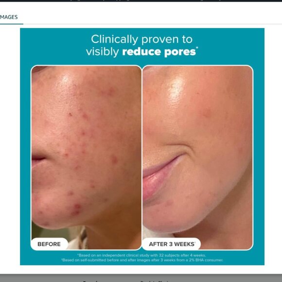 3/59$ Paula's Choice SKIN PERFECTING 2% BHA Liquid Salicylic Acid Exfoliant - Picture 3 of 5